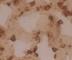 Lysosome-associated membrane glycoprotein 3 antibody, DDX0193B-100, Novus Biologicals, Immunohistochemistry paraffin image 