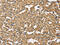 Dynactin Subunit 2 antibody, CSB-PA176976, Cusabio, Immunohistochemistry paraffin image 