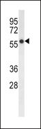 Fatty Acid Desaturase 2 antibody, LS-C165916, Lifespan Biosciences, Western Blot image 