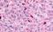 MAS Related GPR Family Member X1 antibody, NLS2756, Novus Biologicals, Immunohistochemistry paraffin image 