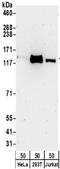 Kinesin Family Member 5A antibody, NBP2-32231, Novus Biologicals, Western Blot image 