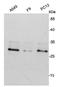 CD3d Molecule antibody, orb49141, Biorbyt, Western Blot image 