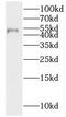 Inositol Hexakisphosphate Kinase 2 antibody, FNab04371, FineTest, Western Blot image 