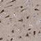 Chromosome 9 Open Reading Frame 135 antibody, NBP1-90684, Novus Biologicals, Immunohistochemistry paraffin image 