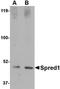 Sprouty Related EVH1 Domain Containing 1 antibody, orb75079, Biorbyt, Western Blot image 