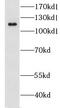 Glutamate Ionotropic Receptor Kainate Type Subunit 2 antibody, FNab03648, FineTest, Western Blot image 