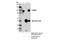 Protein Tyrosine Phosphatase Non-Receptor Type 22 antibody, 14693S, Cell Signaling Technology, Immunoprecipitation image 