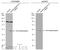 Transforming Growth Factor Beta Receptor 1 antibody, GTX134209, GeneTex, Western Blot image 