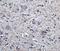 FOXP3 antibody, NBP2-41205, Novus Biologicals, Immunohistochemistry paraffin image 