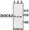 Dedicator Of Cytokinesis 2 antibody, A03836, Boster Biological Technology, Western Blot image 