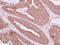 NME/NM23 Family Member 9 antibody, GTX117495, GeneTex, Immunohistochemistry paraffin image 