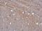 Solute Carrier Family 6 Member 1 antibody, GTX133150, GeneTex, Immunohistochemistry paraffin image 