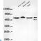 Transducin Beta Like 1 X-Linked Receptor 1 antibody, LS-C813130, Lifespan Biosciences, Western Blot image 