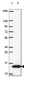 Cystatin B antibody, NBP2-49285, Novus Biologicals, Western Blot image 