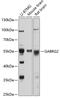 Gamma-Aminobutyric Acid Type A Receptor Gamma2 Subunit antibody, 16-916, ProSci, Western Blot image 