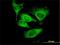 Eukaryotic Translation Initiation Factor 5 antibody, H00001983-M01, Novus Biologicals, Immunocytochemistry image 