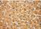 Glucosamine-Phosphate N-Acetyltransferase 1 antibody, 16282-1-AP, Proteintech Group, Immunohistochemistry frozen image 