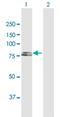 Iduronate 2-Sulfatase antibody, H00003423-D01P, Novus Biologicals, Western Blot image 