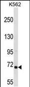 Rac/Cdc42 Guanine Nucleotide Exchange Factor 6 antibody, PA5-48791, Invitrogen Antibodies, Western Blot image 