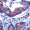 Insulin Receptor Substrate 1 antibody, PA5-32455, Invitrogen Antibodies, Immunohistochemistry paraffin image 