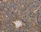 Actin Alpha 1, Skeletal Muscle antibody, LS-C404497, Lifespan Biosciences, Immunohistochemistry frozen image 