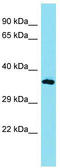 Sosondowah Ankyrin Repeat Domain Family Member D antibody, TA334870, Origene, Western Blot image 