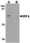 Interferon Regulatory Factor 4 antibody, PA5-21144, Invitrogen Antibodies, Western Blot image 