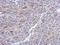 RRM2B antibody, NBP2-19668, Novus Biologicals, Immunohistochemistry frozen image 