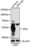 p53 antibody, LS-C746919, Lifespan Biosciences, Western Blot image 