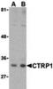 C1q And TNF Related 1 antibody, A09550, Boster Biological Technology, Western Blot image 