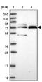 Solute Carrier Family 28 Member 2 antibody, PA5-61142, Invitrogen Antibodies, Western Blot image 