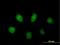 Poly [ADP-ribose] polymerase 3 antibody, H00010039-B01P, Novus Biologicals, Immunocytochemistry image 