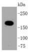 DNA Topoisomerase II Alpha antibody, NBP2-67442, Novus Biologicals, Western Blot image 