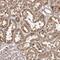 Metastasis-associated in colon cancer protein 1 antibody, PA5-56163, Invitrogen Antibodies, Immunohistochemistry paraffin image 