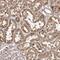 MET Transcriptional Regulator MACC1 antibody, PA5-56163, Invitrogen Antibodies, Immunohistochemistry paraffin image 