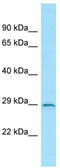 Interleukin 3 Receptor Subunit Alpha antibody, TA343332, Origene, Western Blot image 