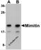 B17.2-like antibody, 5445, ProSci, Western Blot image 