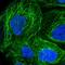 SNF2 Histone Linker PHD RING Helicase antibody, NBP1-92387, Novus Biologicals, Immunofluorescence image 