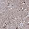 Pyruvate Dehydrogenase Complex Component X antibody, HPA038485, Atlas Antibodies, Immunohistochemistry paraffin image 