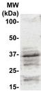 Cyclin-G1 antibody, TA354345, Origene, Western Blot image 