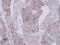 NADH:Ubiquinone Oxidoreductase Core Subunit S2 antibody, GTX114924, GeneTex, Immunohistochemistry paraffin image 