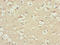 CEAP antibody, LS-C675422, Lifespan Biosciences, Immunohistochemistry paraffin image 