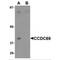 Coiled-Coil Domain Containing 69 antibody, MBS150472, MyBioSource, Western Blot image 