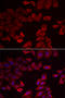Selenide, water dikinase 1 antibody, 22-236, ProSci, Immunofluorescence image 
