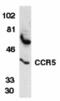 C-C Motif Chemokine Receptor 5 (Gene/Pseudogene) antibody, 1112, QED Bioscience, Western Blot image 