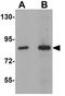 Tripartite Motif Containing 71 antibody, GTX85001, GeneTex, Western Blot image 