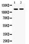 EPH Receptor A5 antibody, PB9583, Boster Biological Technology, Western Blot image 