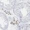 AP000322.53 antibody, NBP1-91141, Novus Biologicals, Immunohistochemistry paraffin image 