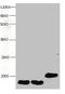 Fatty Acid Binding Protein 3 antibody, LS-C212299, Lifespan Biosciences, Western Blot image 