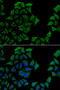 Transcobalamin-1 antibody, STJ28497, St John